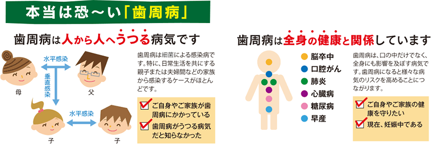 本当は恐い歯周病